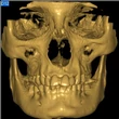 NewTom 3G 9" használt CBCT