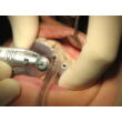 UniGuide / Artiglio műtéti sablonkészítőrendszer